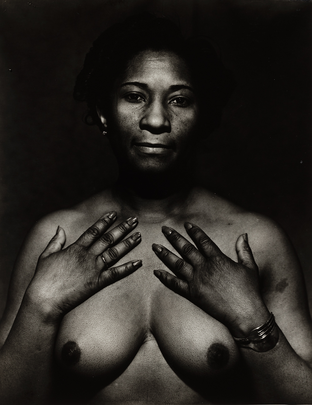 Photograph of a nude Black woman shown from the waist up facing the viewer with both hands on upper chest